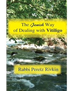 Jewish Way Of Dealing Vitligo